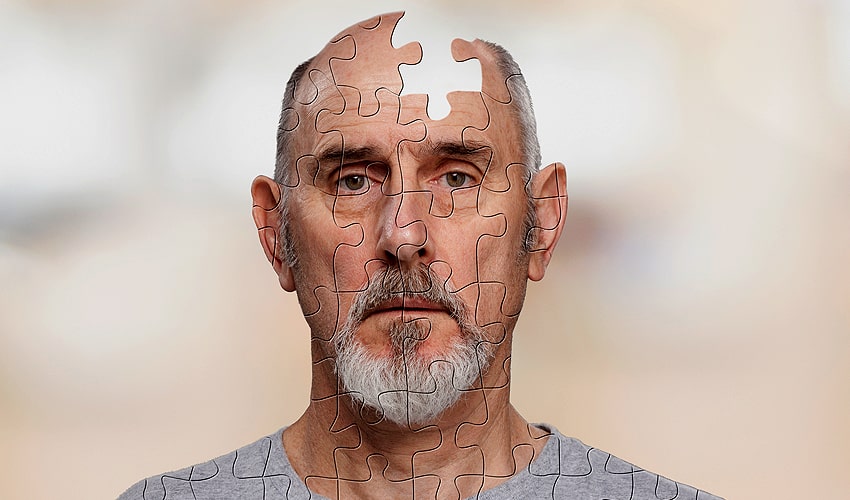 альцгеймер альцгеймер