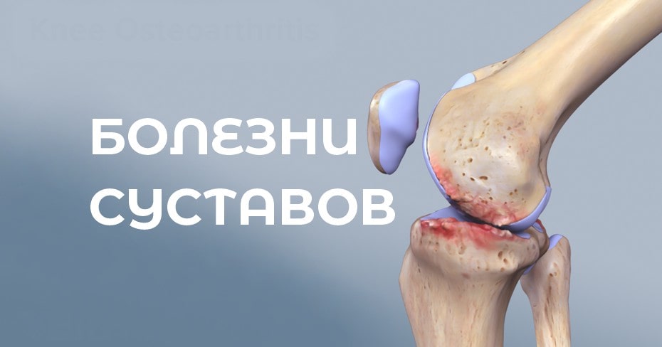болезни суставов болезни суставов